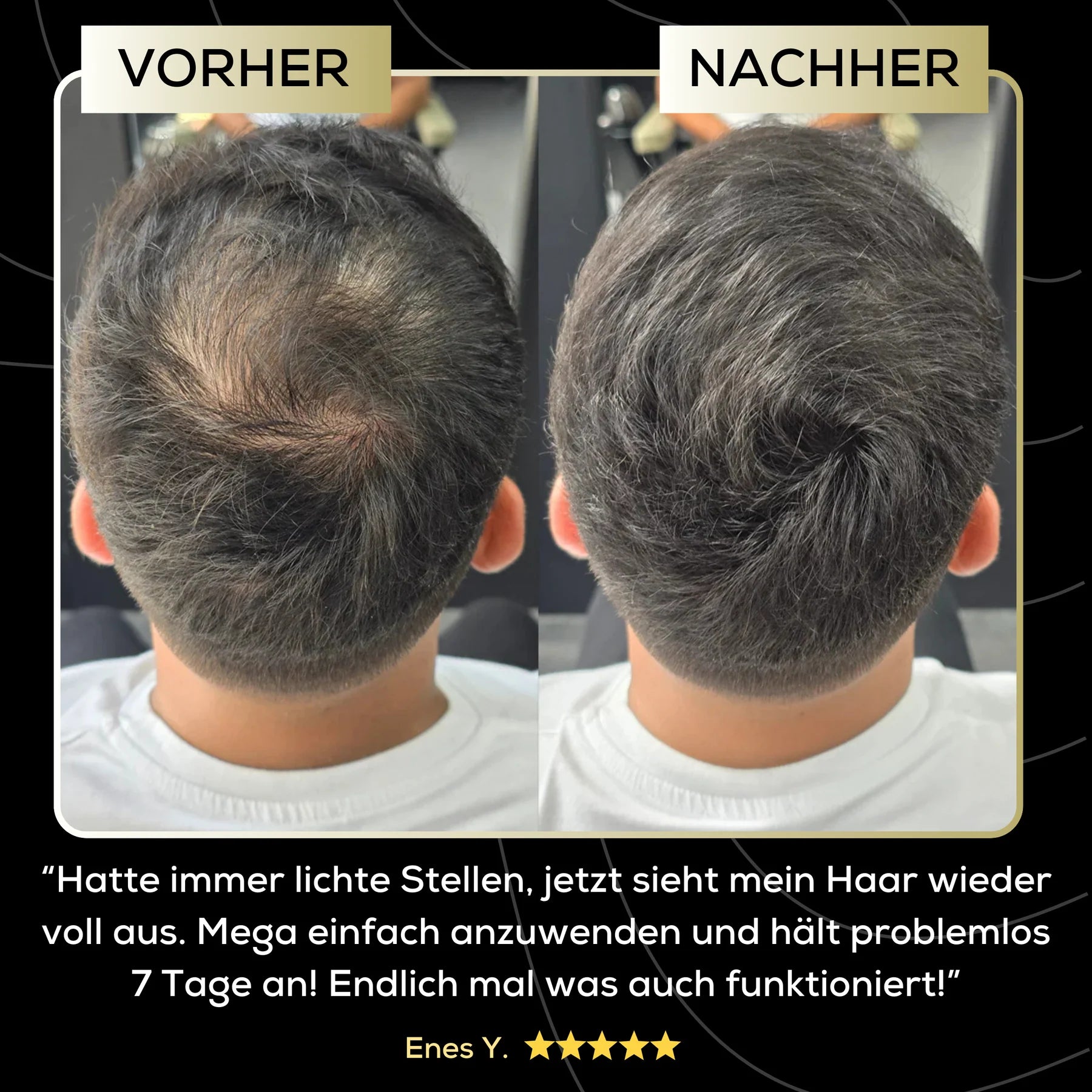 MensMen™ - MagicHair für volles & selbstbewusstes Haar