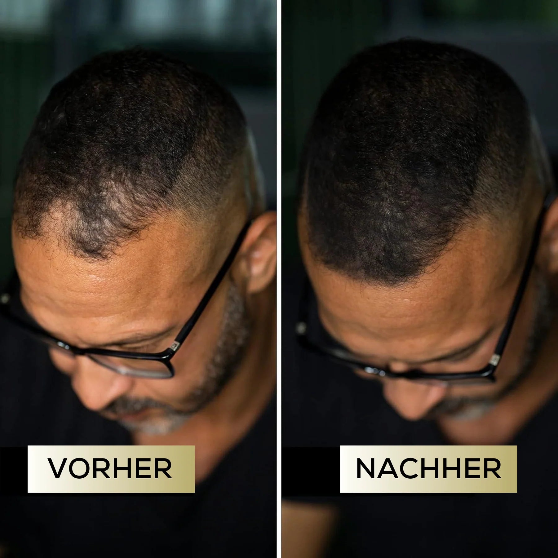MensMen™ - MagicHair für volles & selbstbewusstes Haar