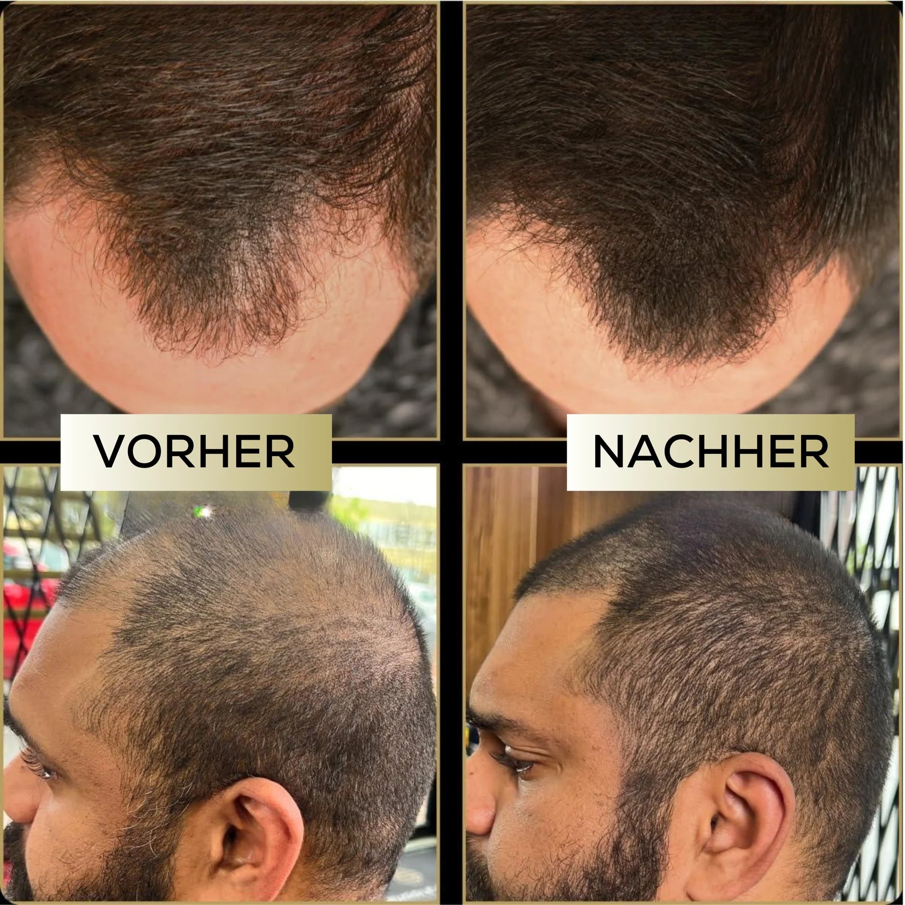 MensMen™ - MagicHair für volles & selbstbewusstes Haar