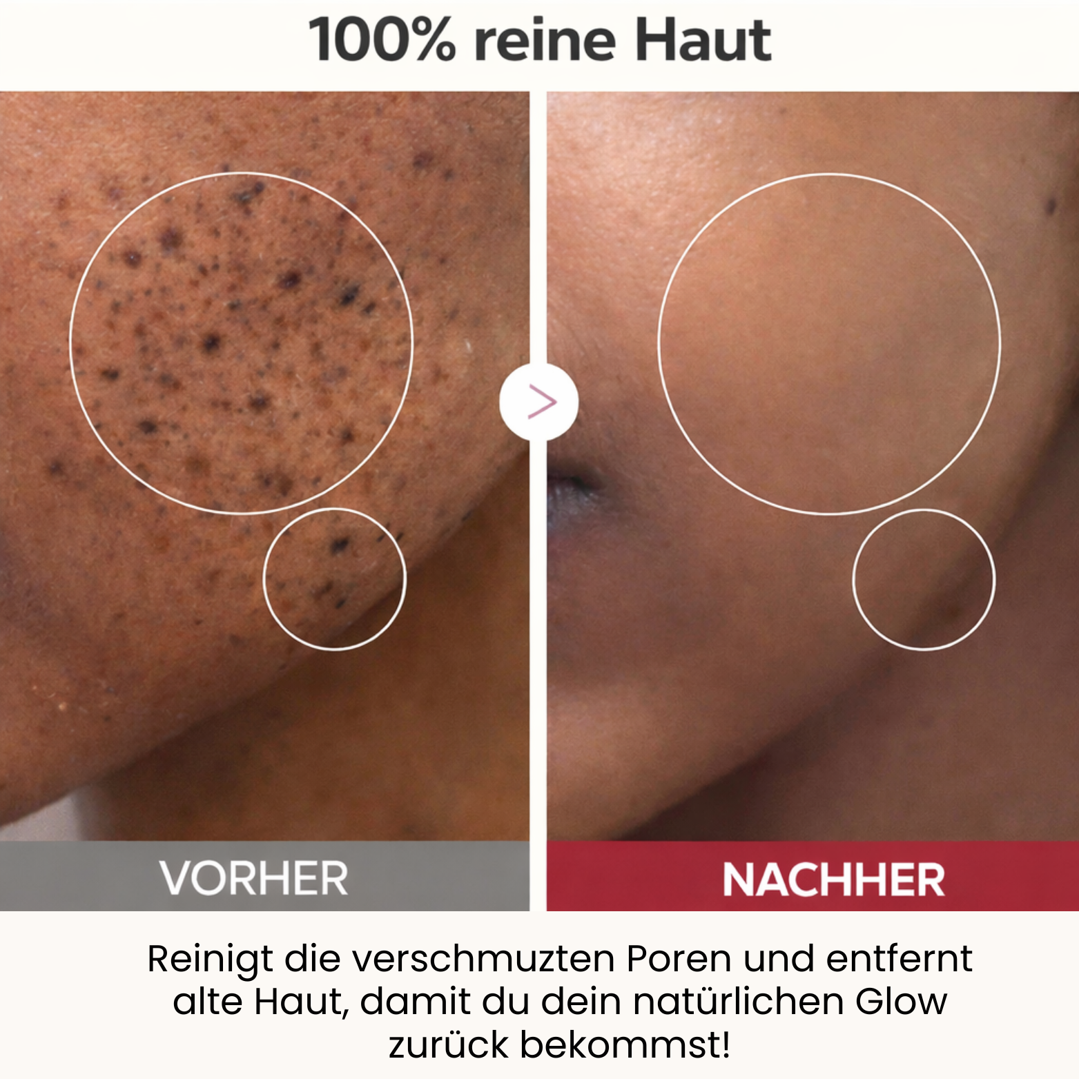 Dr. Melaxin Peel Shot Glow Renewal™